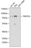 Cell Biology Antibodies 10 Anti-TRMT2A Antibody CAB7095