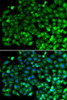 Cell Death Antibodies 2 Anti-Bif-1 Antibody CAB7104