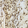 Neuroscience Anti-ACTL6B Antibody CAB7108