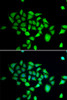 Cell Death Antibodies 2 Anti-DPP8 Antibody CAB7113