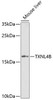 Cell Cycle Antibodies 2 Anti-TXNL4B Antibody CAB7114