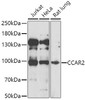 ChIP Antibodies Anti-CCAR2 Antibody CAB7126