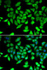 ChIP Antibodies Anti-CCAR2 Antibody CAB7126