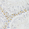 ChIP Antibodies Anti-ELAC2 Antibody CAB7128