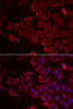 ChIP Antibodies Anti-MARCKSL1 Antibody CAB7132