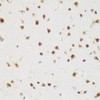 ChIP Antibodies Anti-BRD9 Antibody CAB7133