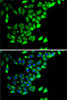 ChIP Antibodies Anti-PTGES2 Antibody CAB7137