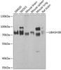 Cell Biology Antibodies 11 Anti-UBASH3B Antibody CAB7141