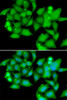 Cell Biology Antibodies 11 Anti-UBASH3B Antibody CAB7141