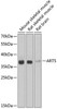 Cell Biology Antibodies 11 Anti-ART5 Antibody CAB7146