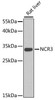 Immunology Antibodies 2 Anti-NCR3 Antibody CAB7153