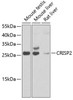 Cell Biology Antibodies 11 Anti-CRISP2 Antibody CAB7177
