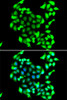 Epigenetics and Nuclear Signaling Antibodies 4 Anti-GTF2H3 Antibody CAB7188