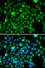 Cell Biology Antibodies 11 Anti-N6AMT1 Antibody CAB7201