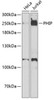 Cell Biology Antibodies 11 Anti-PHIP Antibody CAB7207