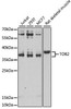 Cell Biology Antibodies 11 Anti-TOB2 Antibody CAB7223