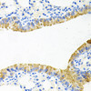 Cell Biology Antibodies 11 Anti-TOB2 Antibody CAB7223