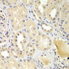 Cell Death Antibodies 2 Anti-UBE2Z Antibody CAB7225