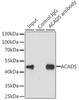 Metabolism Antibodies 2 Anti-ACADS Antibody CAB7230