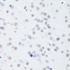 Epigenetics and Nuclear Signaling Antibodies 4 Anti-TriMethyl-Histone H3-K64 Antibody CAB7259