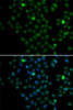 Epigenetics and Nuclear Signaling Antibodies 4 Anti-LMO4 Antibody CAB7268