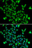 Cell Biology Antibodies 11 Anti-ASPA Antibody CAB7271