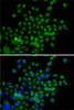 Cardiovascular Antibodies Anti-BCAS3 Antibody CAB7274