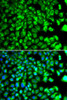 Cell Biology Antibodies 11 Anti-C10orf32 Antibody CAB7276