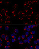 Cell Biology Antibodies 11 Anti-GOLM1 Antibody CAB7283