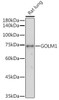 Cell Biology Antibodies 11 Anti-GOLM1 Antibody CAB7283