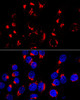 Cell Biology Antibodies 11 Anti-GOLM1 Antibody CAB7283