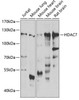 Epigenetics and Nuclear Signaling Antibodies 4 Anti-HDAC7 Antibody CAB7285