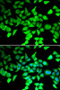 Epigenetics and Nuclear Signaling Antibodies 4 Anti-HDAC7 Antibody CAB7285