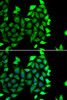 Immunology Antibodies 2 Anti-IKZF3 Antibody CAB7287