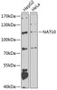 Epigenetics and Nuclear Signaling Antibodies 4 Anti-NAT10 Antibody CAB7292