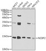 Epigenetics and Nuclear Signaling Antibodies 4 Anti-NCBP2 Antibody CAB7293