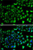 Epigenetics and Nuclear Signaling Antibodies 4 Anti-NFYB Antibody CAB7295