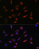 Cell Death Antibodies 2 Anti-PDCD5 Antibody CAB7298