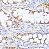 Cell Biology Antibodies 11 Anti-SMYD4 Antibody CAB7310