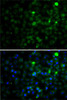 Cell Biology Antibodies 11 Anti-SMYD4 Antibody CAB7310