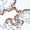 Cell Biology Antibodies 11 Anti-SMYD4 Antibody CAB7310