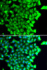 Cell Death Antibodies 2 Anti-TRIAP1 Antibody CAB7313
