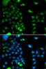 Signal Transduction Antibodies 3 Anti-UBE2J2 Antibody CAB7316