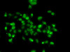 Cell Biology Antibodies 11 Anti-WBSCR22 Antibody CAB7317