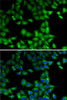 Cell Biology Antibodies 11 Anti-MPI Antibody CAB7319