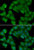 Signal Transduction Antibodies 3 Anti-HBA1 Antibody CAB7322