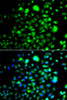 Cell Biology Antibodies 11 Anti-PEX14 Antibody CAB7336