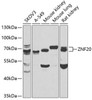 Epigenetics and Nuclear Signaling Antibodies 4 Anti-ZNF20 Antibody CAB7346