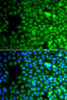 Epigenetics and Nuclear Signaling Antibodies 4 Anti-ZNF195 Antibody CAB7347