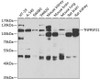 Immunology Antibodies 2 Anti-TNFRSF21 Antibody CAB7365